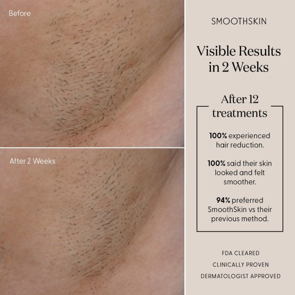 SmoothSkin Pure Adapt Green IPL Laser Hair Removal Device for Women & Men, - Image 6