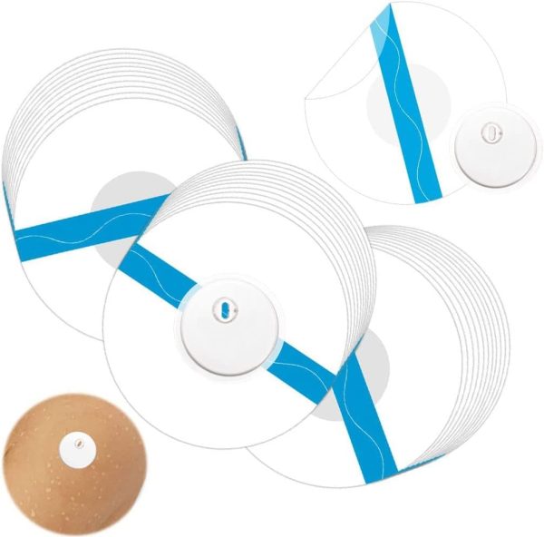 continuous glucose monitor