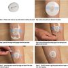 continuous glucose monitor