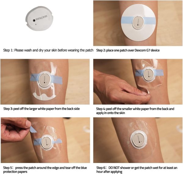 continuous glucose monitor