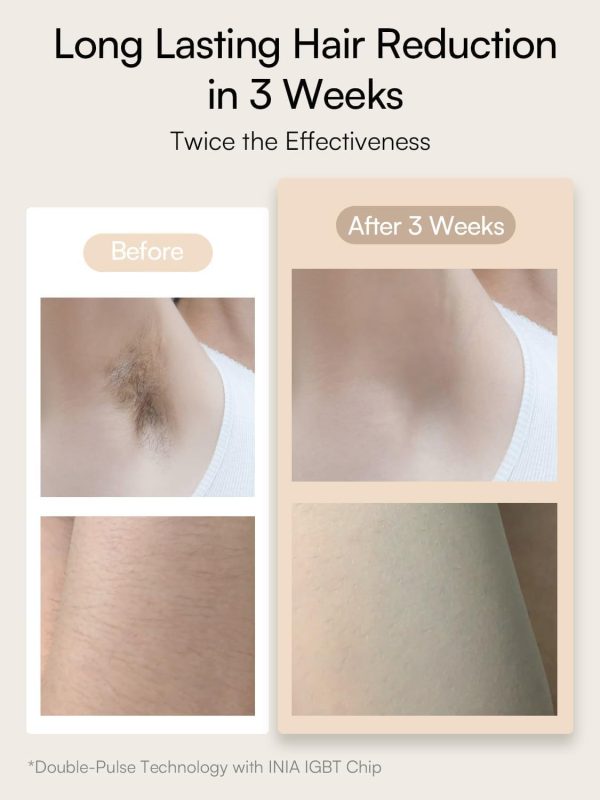 Laser Hair Removal for Women and Men, IPL Hair Removal Device with Sapphire - Image 4