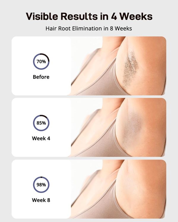 AMOTAOS Laser Hair Removal, Ice Cooling IPL Hair Removal for Women, - Image 2
