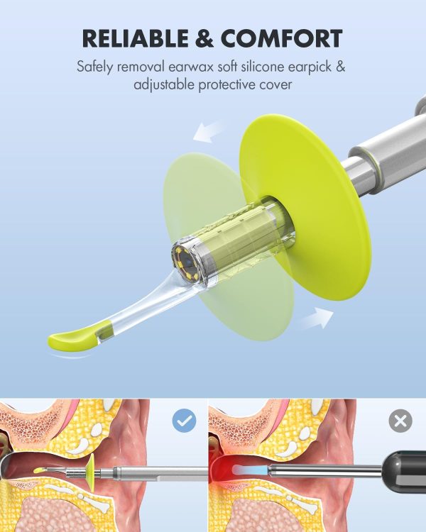 Anykit Digital Otoscope with Gyroscope, 4.5 Inches Screen, 3.9mm Ear Scope - Image 5