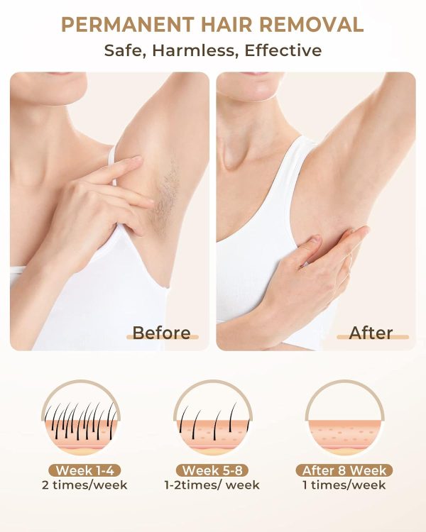 LYSMOSKI Laser Hair Removal Device for Women and Men at Home IPL Hair - Image 2