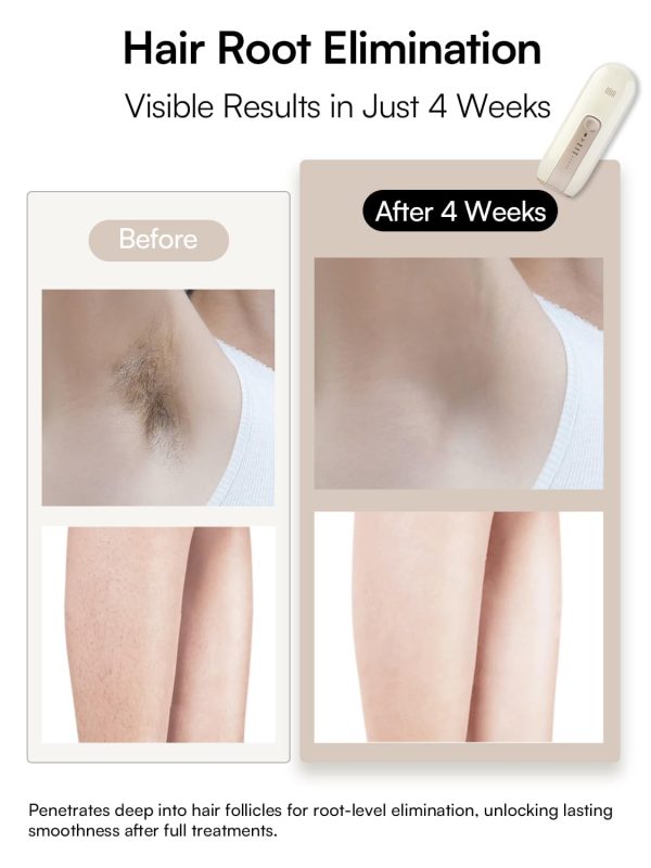 Laser Hair Removal Device for Women and Men, INIA Fond Hair Remover with - Image 4
