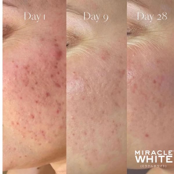 Beauty Glow Glutathione - Image 6