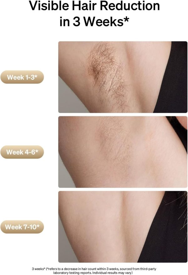 Ulike Laser Hair Removal, Air 3 IPL Hair Removal with Gift Set, Sapphire - Image 4