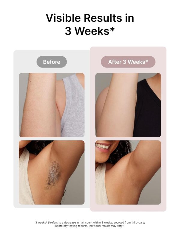 Ulike Laser Hair Removal for Women and Men, Air 3 Ice-Cooling IPL Device - Image 3
