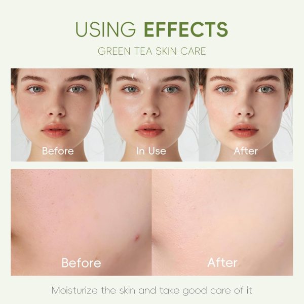 Green Tea Skincare Set, Organic Skin Care Set, Facial Kit for Women/Teenage - Image 5