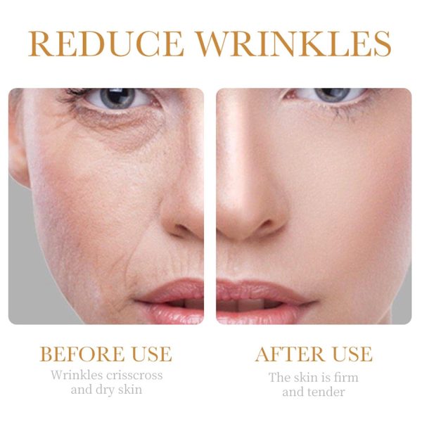 Collagen Skin Care Set, 6Pcs Anti Aging Face Care Sets for Women, Firming - Image 3