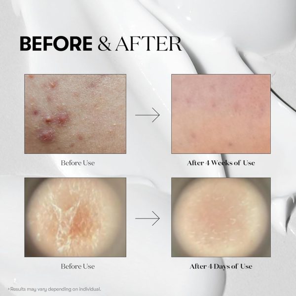 VT COSMETICS CICA Reedle Shot 700, Spot Treatment Night Exosome, - Image 5