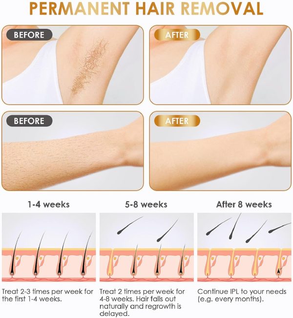 Laser Hair Removal Device at-Home Gransumr IPL Permanent Painless Hair - Image 3