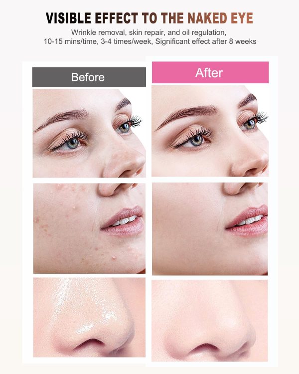 Red Light Therapy for Face,3 Modes LED Face Mask Light - Image 4