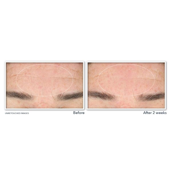 RoC Retinol Correxion Deep Wrinkle Serum Facial Cleanser with Niacinamide - Image 3