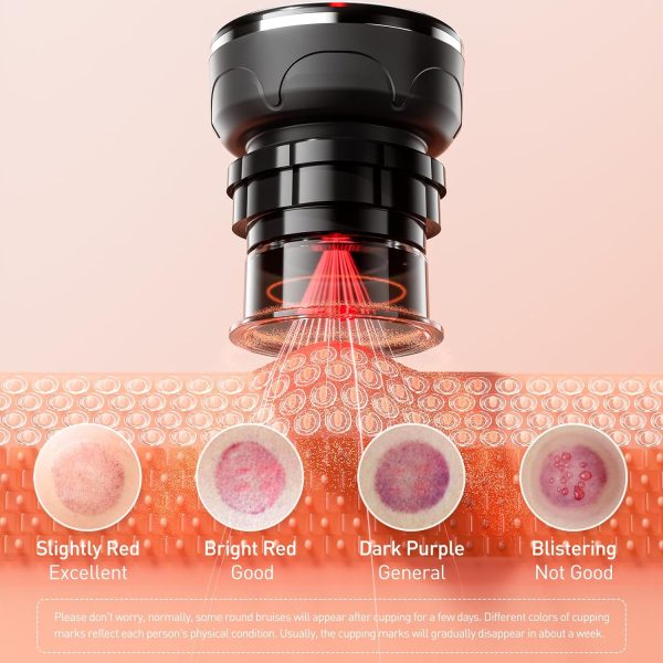 UBALANCE Smart Cupping Therapy Set - Cellulite Massager with 6 Massage - Image 5