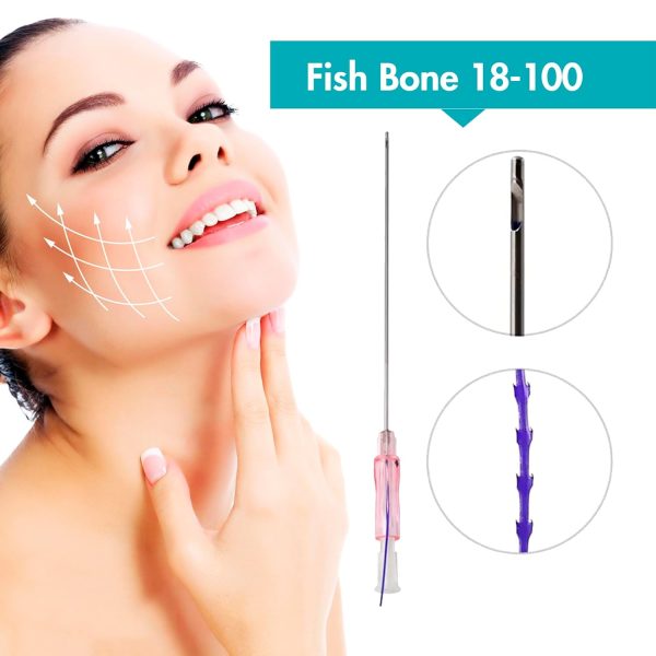 PDO Fish Bone Cog Threads, Can Effectively Lift Loose Body Skin and Make it - Image 2