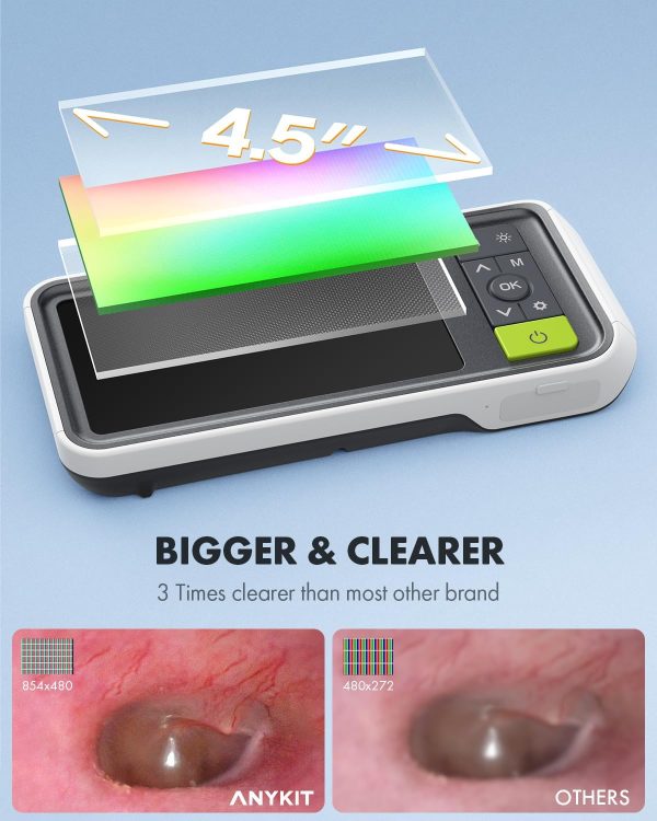 Anykit Digital Otoscope with Gyroscope, 4.5 Inches Screen, 3.9mm Ear Scope - Image 6