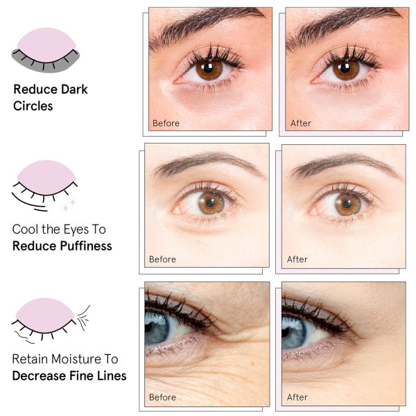 grace & stella Award Winning Under Eye Mask (Blue, 6 Pairs) Reduce Dark - Image 3