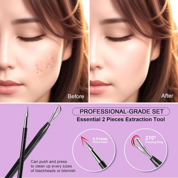 Teenitor Pimple Extractor Tool Comedone Extractor Acne Tool Blackhead - Image 6