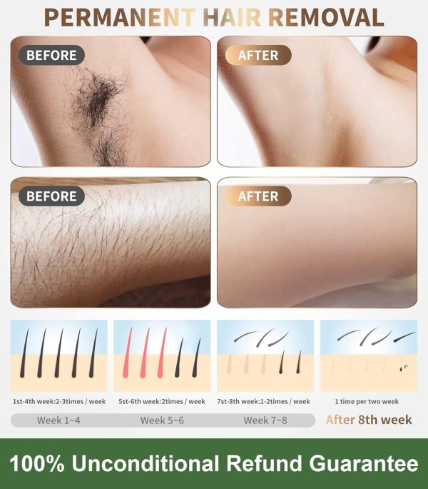 IPL Laser Permanent Hair Removal Device for Women and Men, Painless Best - Image 4