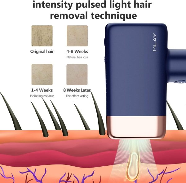 MLAY IPL Hair Removal Device, Ice Cooling Protection Laser Whole Body Hair - Image 2