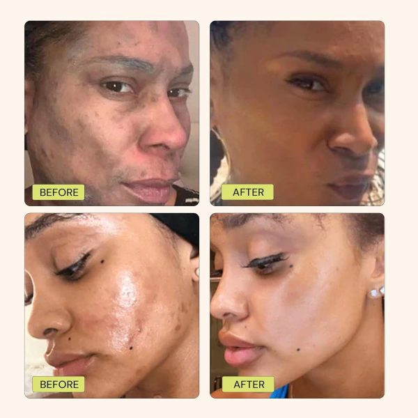 Gleamin Vitamin C Clay Mask for Dark Spots,10-Minutes Turmeric Clay Face - Image 4