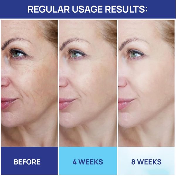 Retinol Cream for Face with Hyaluronic Acid, Day-Night Anti-Aging - Image 9