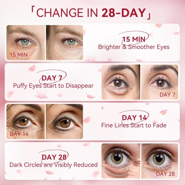 BREYLEE Rose Eye Mask– 60 Pcs, Under Eye Patches,Eye Patches For Puffy - Image 6