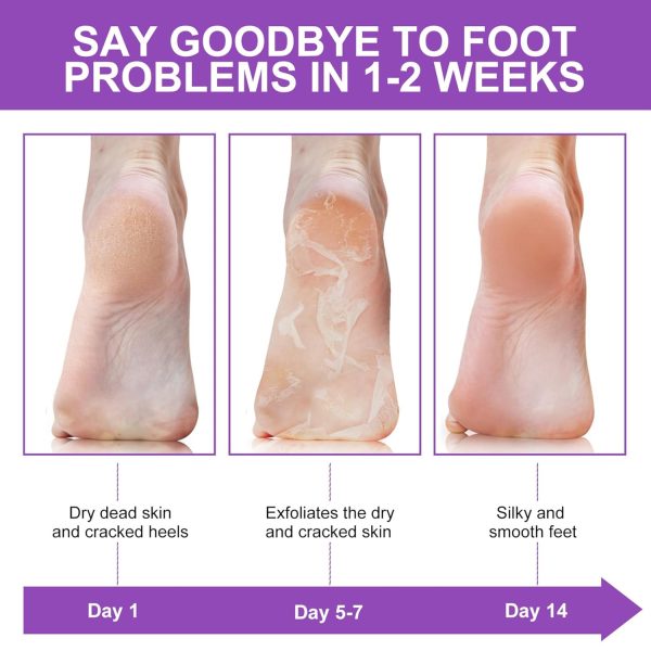 ALIVER Foot Peel Mask 3 Pack, Exfoliator Peel Off Calluses Dead Skin Callus - Image 7