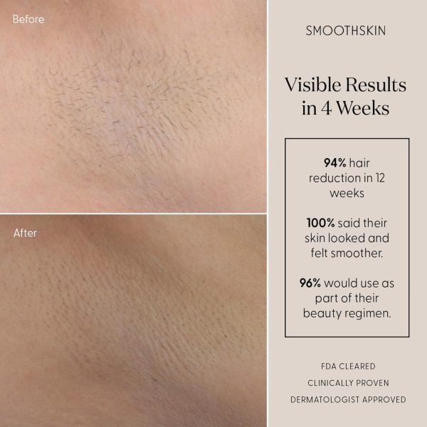 SmoothSkin Pure Mini IPL Laser Hair Removal Device, Long-Lasting, for Body - Image 4