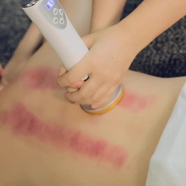3 in 1 Electric Gua Sha Scraping and Vacuum Cup Therapy Machine with Heat – - Image 7