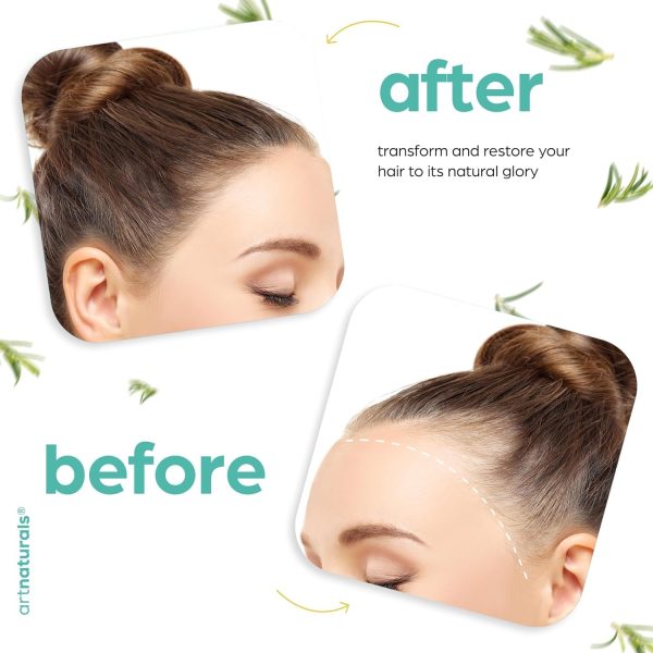 Artnaturals Organic Rosemary Castor Hair Oil + Massager Hair Growth Set - Image 6