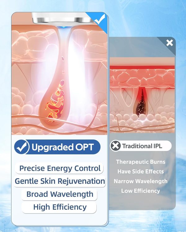 TMOMT OPT Laser Hair Removal Device Permanent, At Home IPL Hair Removal Pro - Image 2