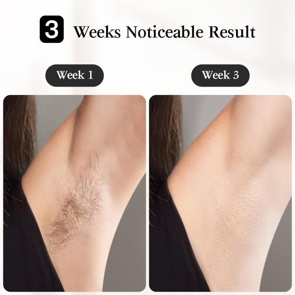 JOVS Laser Hair Removal, [24J Energy] IPL Hair Removal for Women and Men, - Image 3