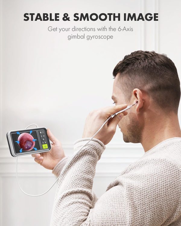 Anykit Digital Otoscope with Gyroscope, 4.5 Inches Screen, 3.9mm Ear Scope - Image 2