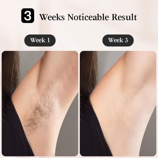 JOVS Laser Hair Removal, [24J Energy] IPL Hair Removal for Women and Men, - Image 3
