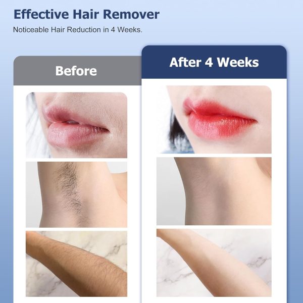 Geesoul Hair Removal Device, Permanent Ice Cooling Hair Removal Machine for - Image 3