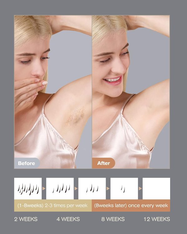 INNZA Laser Hair Removal Device with Sapphire Ice Cooling Function,Upgraded - Image 6
