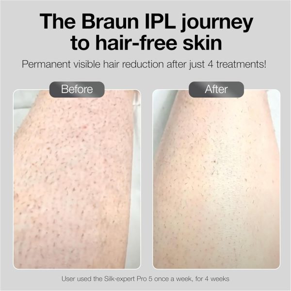 Braun IPL Long-Lasting Hair Removal System for Women and Men, Silk Expert - Image 13