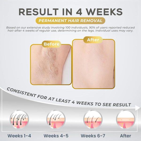 QPTech IPL Laser Ice Cooling Hair Removal Epilator Device For Women & Men, - Image 4