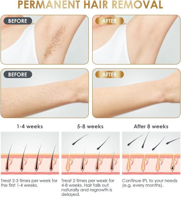 IPL Laser Hair Removal Device for Women and Men, Laser Hair Remover with - Image 4