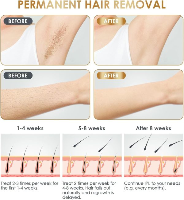 IPL Laser Hair Removal Device at-Home for Women Men NATRSYM Painless - Image 4