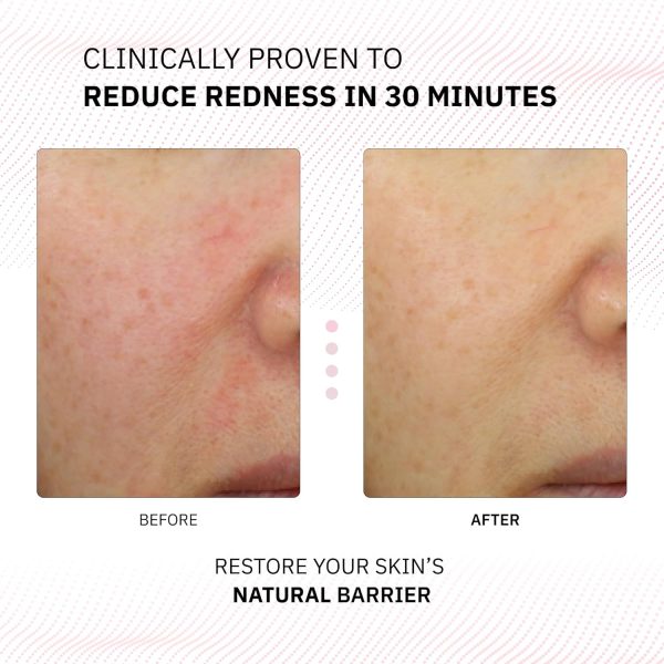 Physiogel Calming Relief Redness Relieving Lotion Reduces Redness in 30 - Image 2