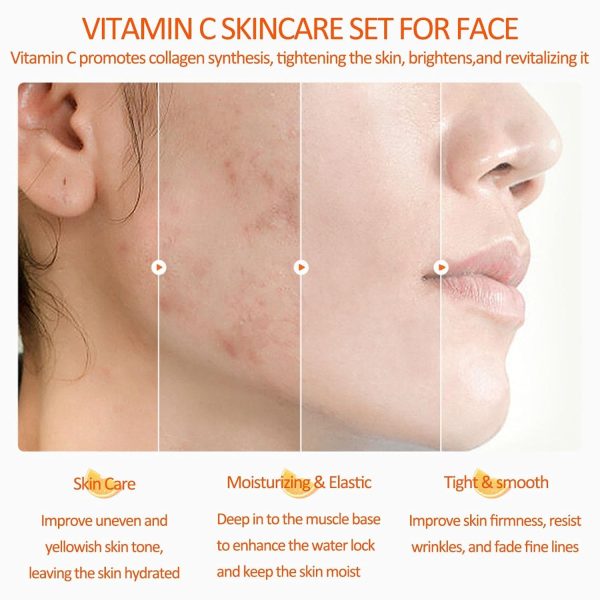 Vitamin C Skincare Set, 5-In-1 Skincare Gift Set With Cleanser, Toner, Face - Image 4