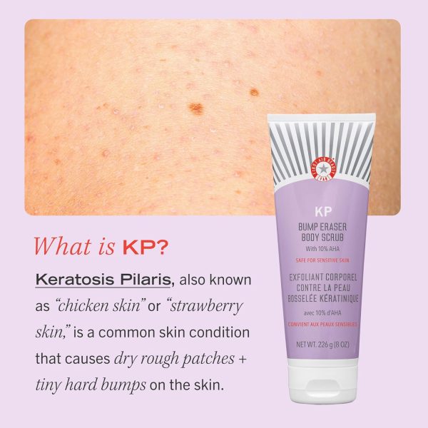First Aid Beauty - KP Bump Eraser Body Scrub with 10% AHA, Keratosis - Image 6