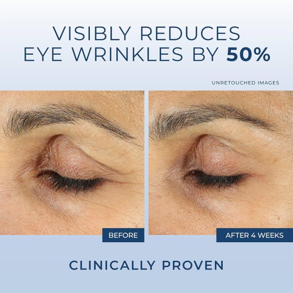 RoC Retinol Correxion Under Eye Cream for Dark Circles & Puffiness, Daily - Image 4