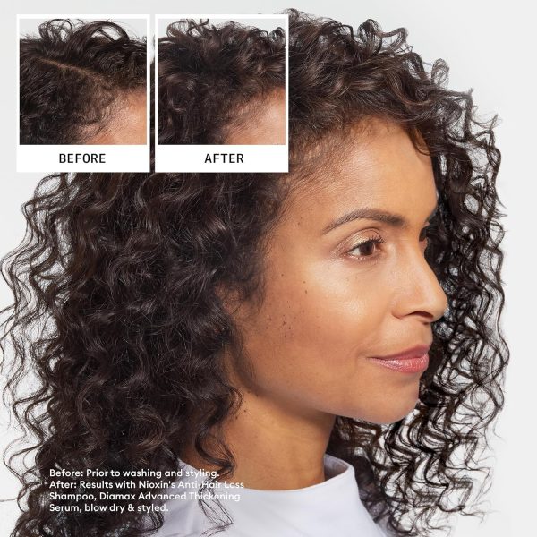 Nioxin Hair Fall Defense Shampoo - Shampoo for Hair Loss - Image 4