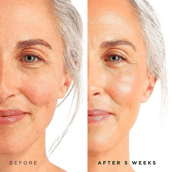 Tree of Life Beauty Retinol Serum, Skin Smoothing Face Oil for Dark and Age - Image 3