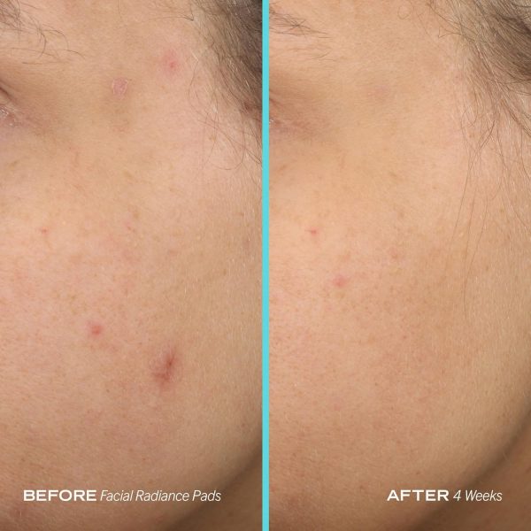 First Aid Beauty - Facial Radiance Pads with Gycloic & Lactic Acids – Daily - Image 7