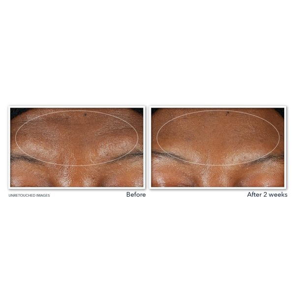 RoC Retinol Correxion Deep Wrinkle Serum Facial Cleanser with Niacinamide - Image 4